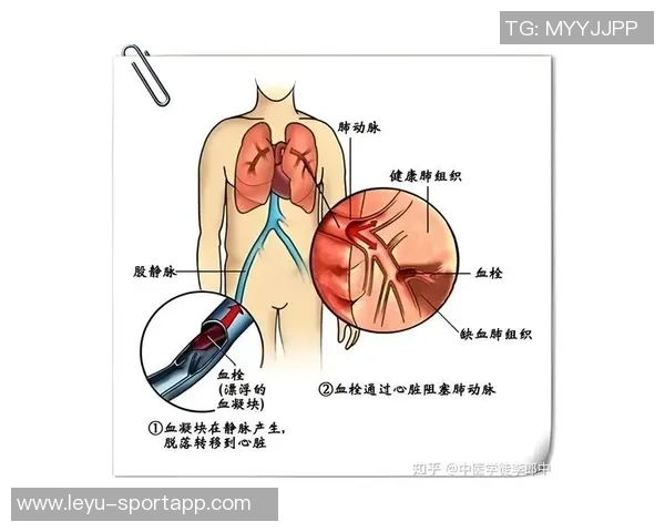 文班谈血栓伤病的医学分析与心理状态的积极应对